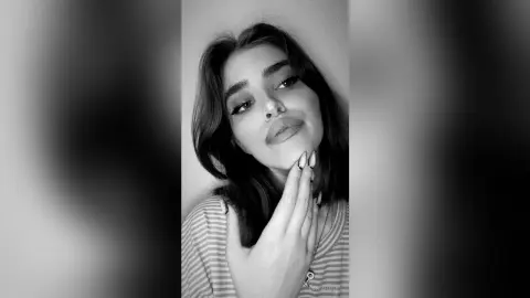 Moody black and white portrait of a young woman in a striped shirt looking thoughtfully into the distance.