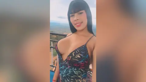 Smiling young woman in a patterned black bikini enjoying a sunny view from a scenic balcony.