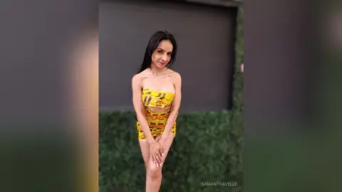 Smiling woman in a yellow strapless patterned mini dress posing outdoors against a green hedge background.