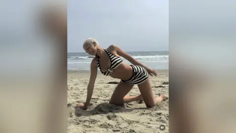 Blonde woman in a black and white striped bikini posing on a sunny beach.