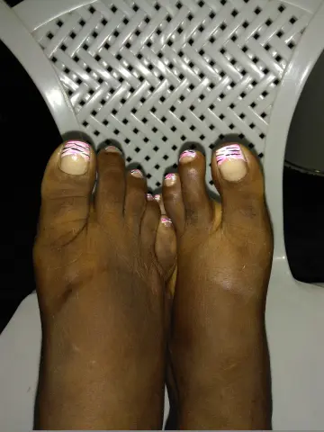 A close-up shot of Ebonyhotxxx's dark-skinned feet with pink and white patterned nail polish resting on a white plastic chair.