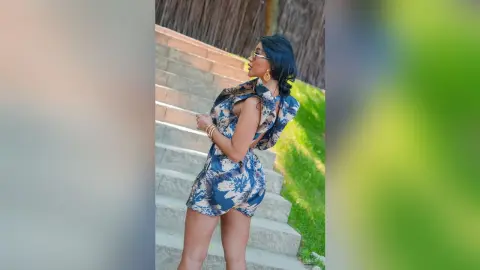 Dolce stands on outdoor stone steps wearing a blue and white floral print romper that shows her bare legs and back.