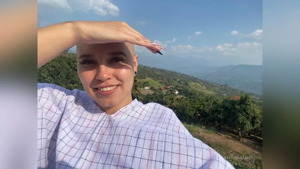 TamyAdamms — bald